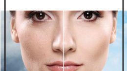 CİLT GENÇLEŞTİRME